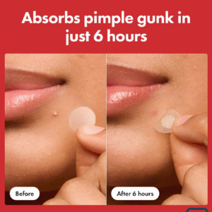 Mighty Patch Original patch